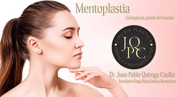 Mentoplastia - Dr. Juan Pablo Quiroga Cuellar - Cirugía Plástica en Cochabamba