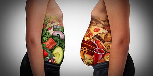 Obesidad Lic. Raisa Torrico Vilte Nutricionista Cochabamba
