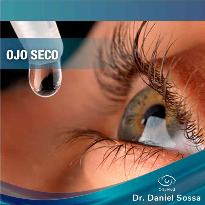 Ojo Seco Dr. Daniel Sossa Mendez Cirujano Oftalmólogo Cochabamba