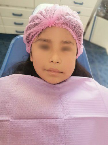 Quistes Dentarios en Niños Centro de Cirugía Bucal y Traumatología Maxilofacial en Bolivia