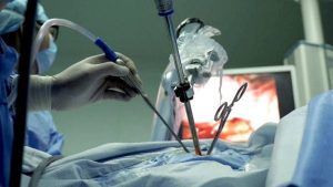 Tratamiento Quirúrgico Mediante Videotoracoscopia y Pleurodesis con Talco del Neumotórax Espontáneo Primario - Dr. Edwin E. Marmol Cazas - Cirujano Torácico - Cochabamba