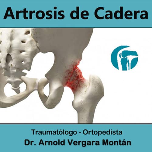 imagen1 - Dr. Arnold Vergara Montan - Traumatólogo Ortopedista