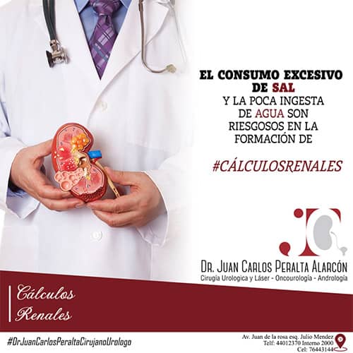 imagen1 - Dr. Juan Carlos Peralta Alarcon Urólogo