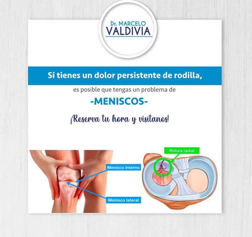 imagen1 - Dr. Marcelo Valdivia Loza - Traumatólogo Ortopedista en cochabamba