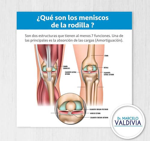 imagen4 - Dr. Marcelo Valdivia Loza - Traumatólogo Ortopedista en cochabamba