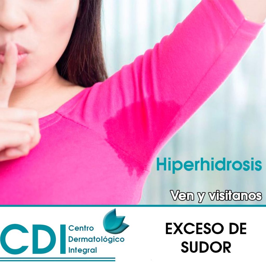 Hiperhidrosis - Dr. Fernando Aguirre - Dermatólogo