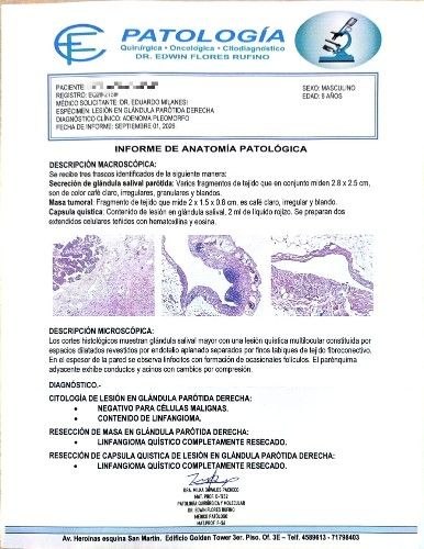 Tumores de la Glándula Parotídea - Cirujano Maxilofacial - Centro de Cirugía y Traumatología Maxilofacial Bolivia