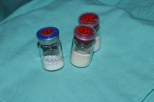 Quistes Maxilares - Cirujano Maxilofacial - Centro de Cirugía y Traumatología Maxilofacial Bolivia